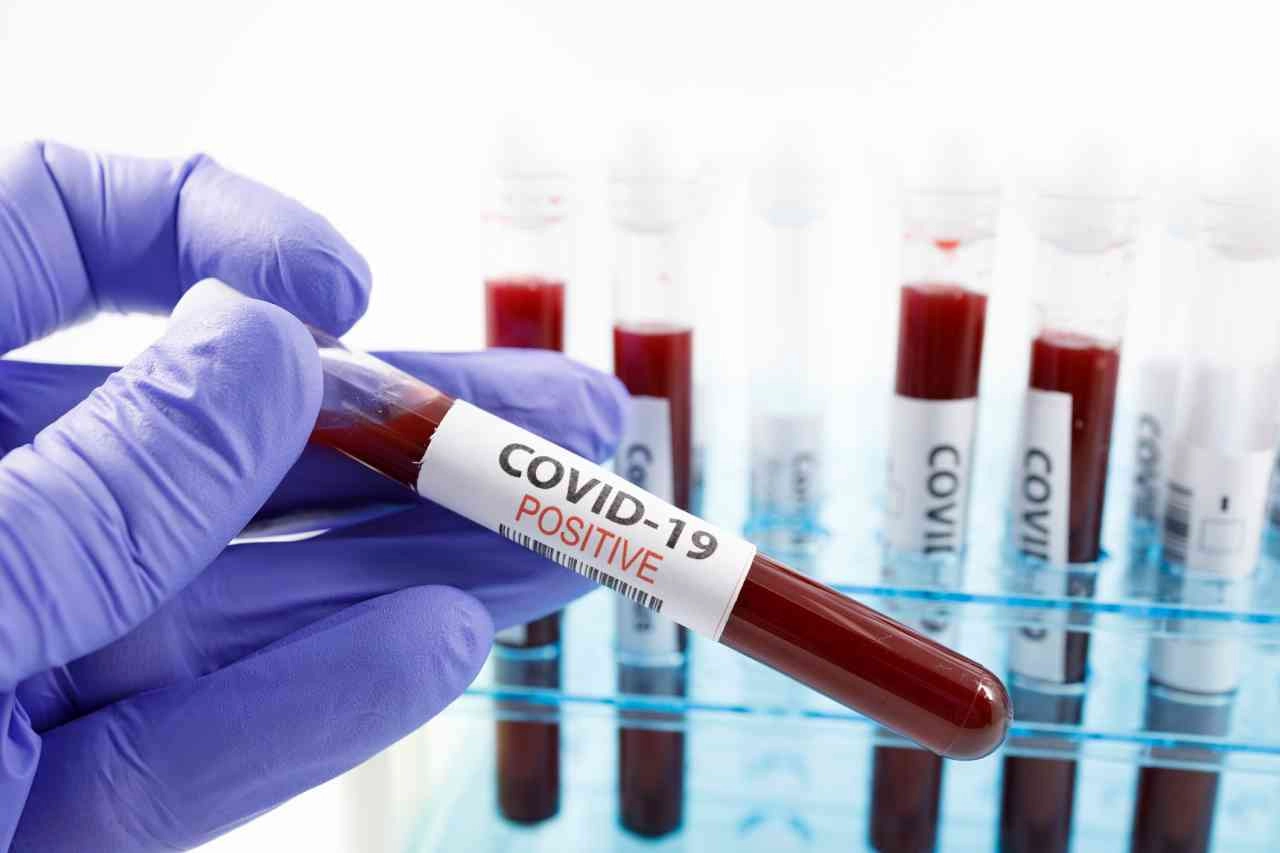 Covid-19 positivo, Credits iStockPhoto